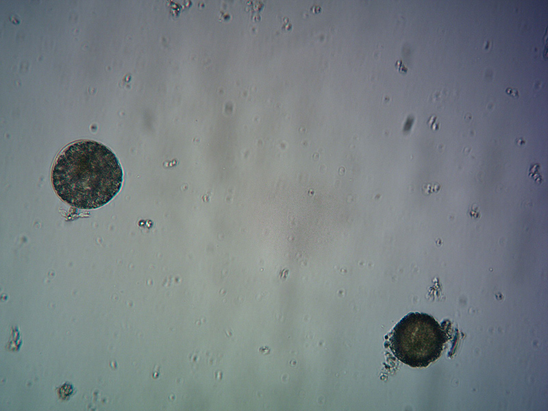 Hamilton Harbour Plankton Under Microscope 1