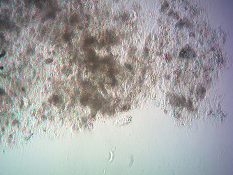Hamilton Harbour Plankton Under Microscope 4